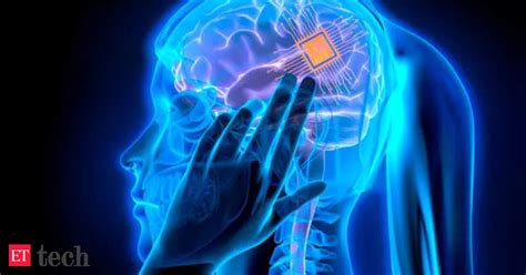 rfid chip in head|Neuralink Implants Brain Chip in First Human: What It Means.